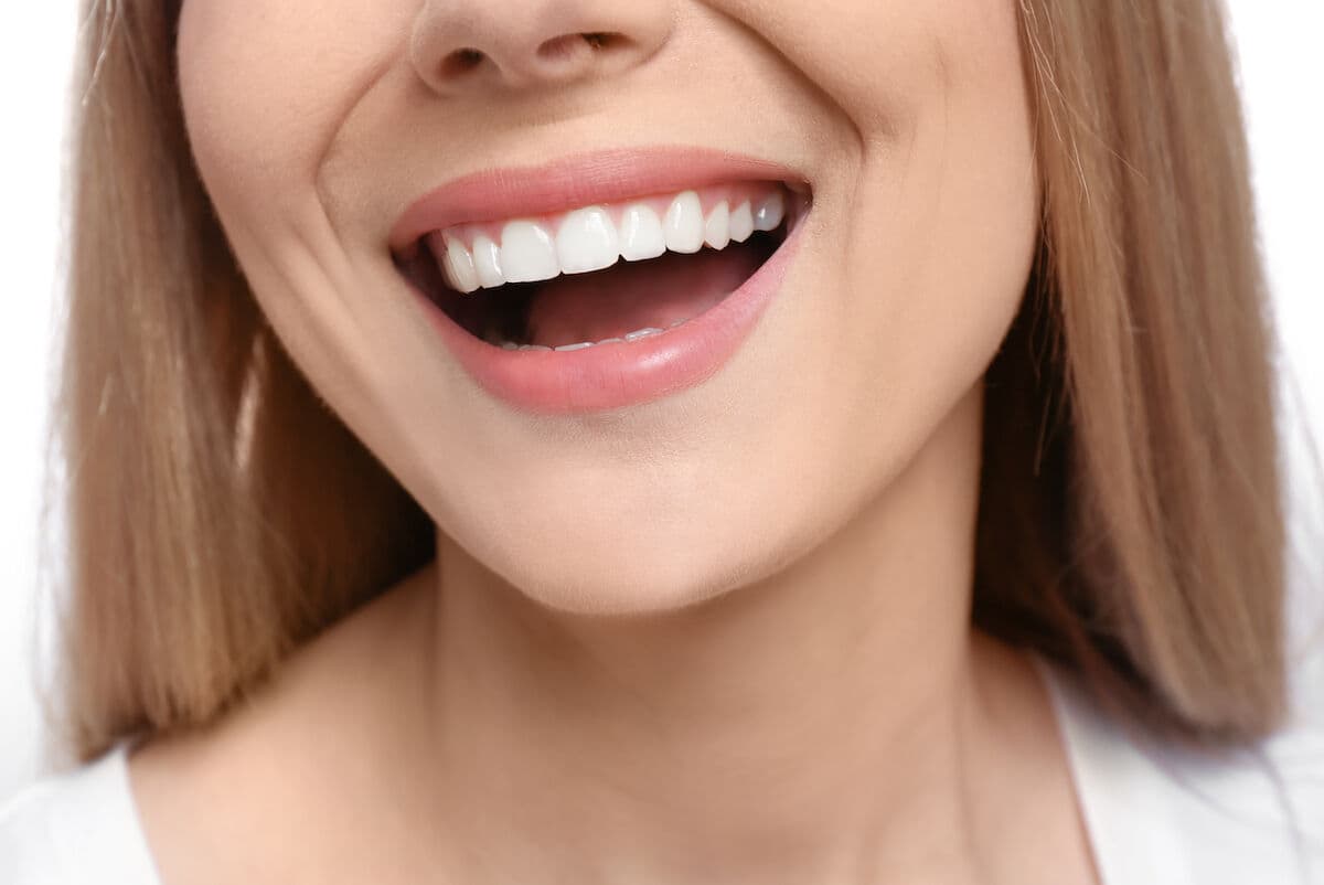 Close-up of a woman's smile after composite bonding