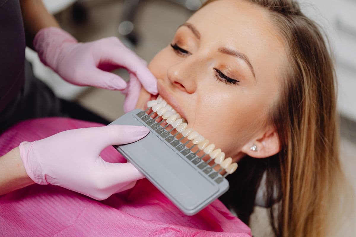 Dentist matching a porcelain veneer shade against a patient's teeth