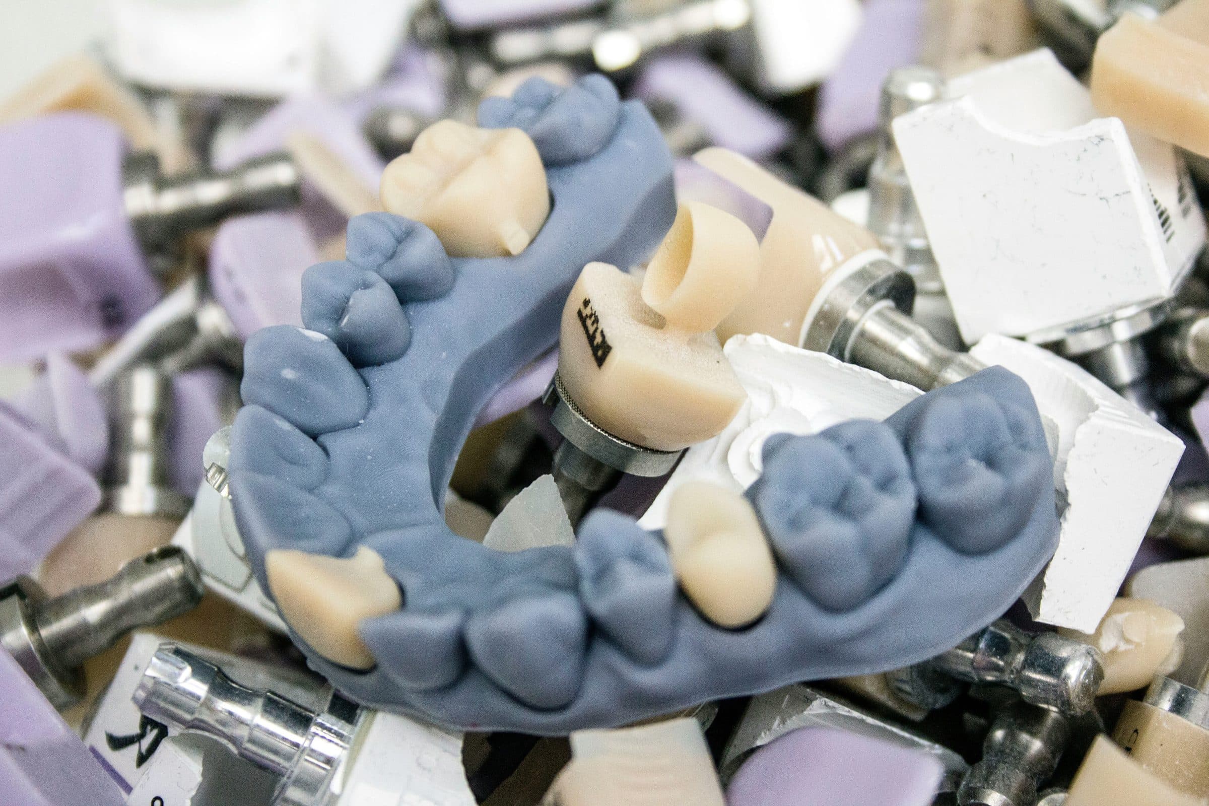 Choosing Between Cement-Retained and Screw-Retained Implant Crowns