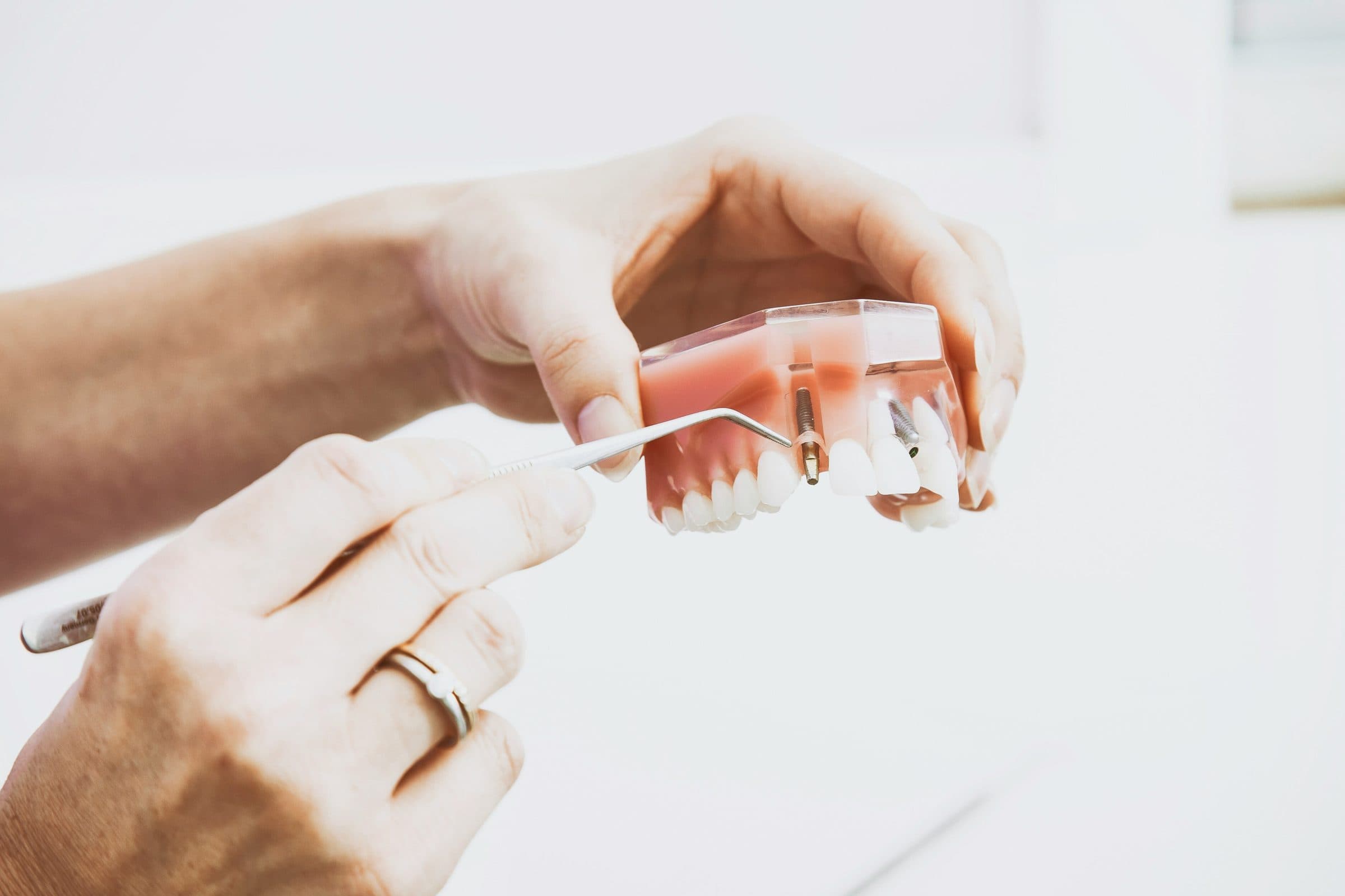 Which Tooth Replacement Option
