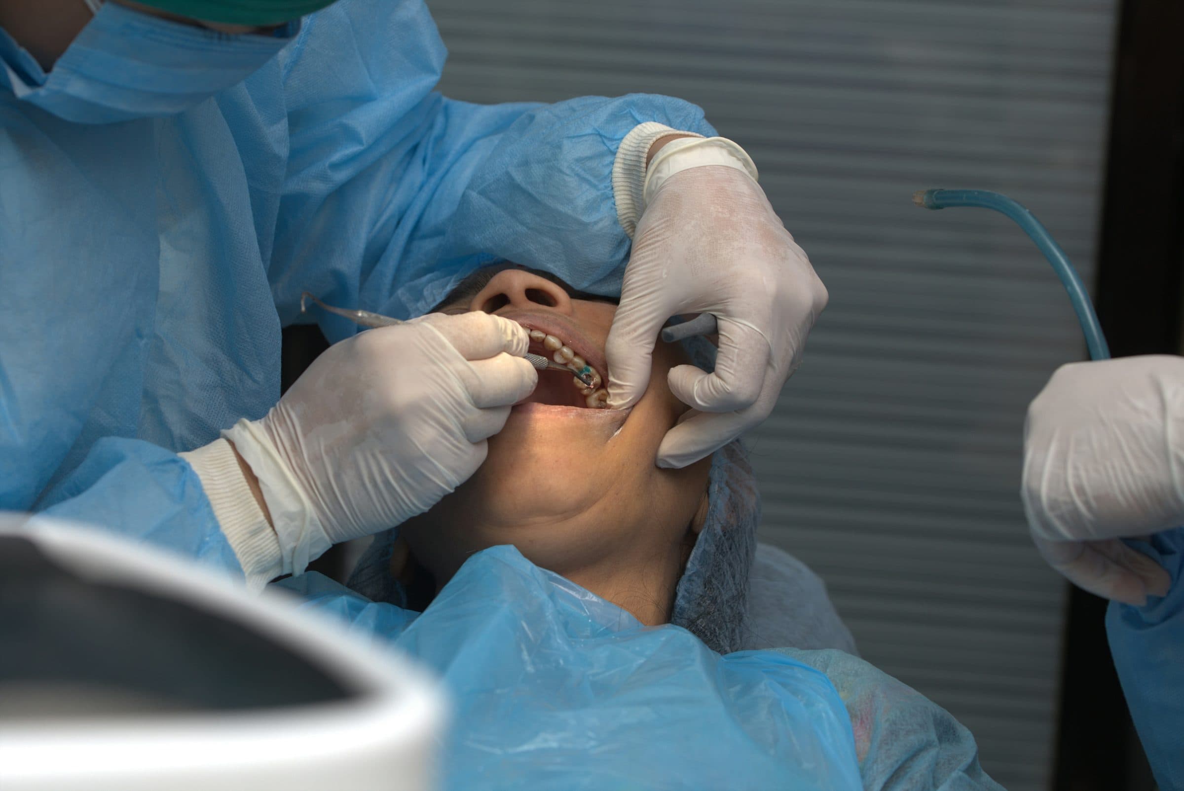 Sinus Lift Surgery for Dental Implants: When It’s Needed and What Recovery Looks Like