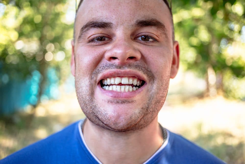 What happens if you ignore a chipped tooth